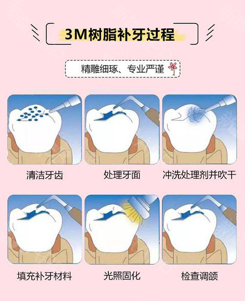 新版2026芜湖牙科收费标准：种植牙/矫正/补牙/拔牙等项目价格表知晓