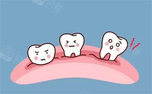 牙龈萎缩卡通展示图片
