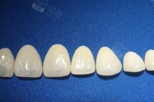 牙冠卡通模型图