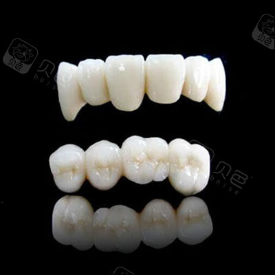 全瓷牙冠修复展示