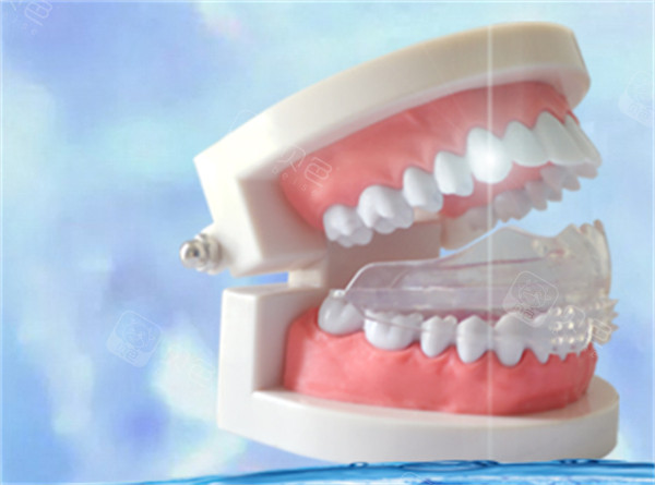 4D牙齿矫正器